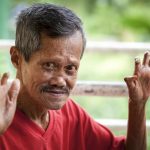 Ketong – Mga Dapat na Malaman Tungkol sa Ketong